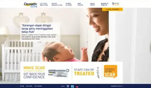 Dermatix Scar Treatment Website UI preview 2